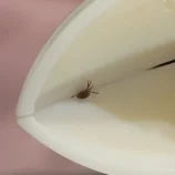 Tick Nipper